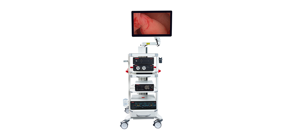 Hysteroscopy System tower for endoscopy with devices, trolley and monitor showing Hysteroscopic procedure